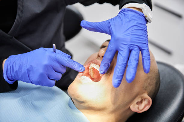 Best Emergency Root Canal Treatment in Utica, SC